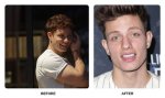Matt Rife's Teeth Transformation: Before and After